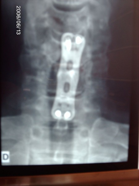 IMAG0293.JPG